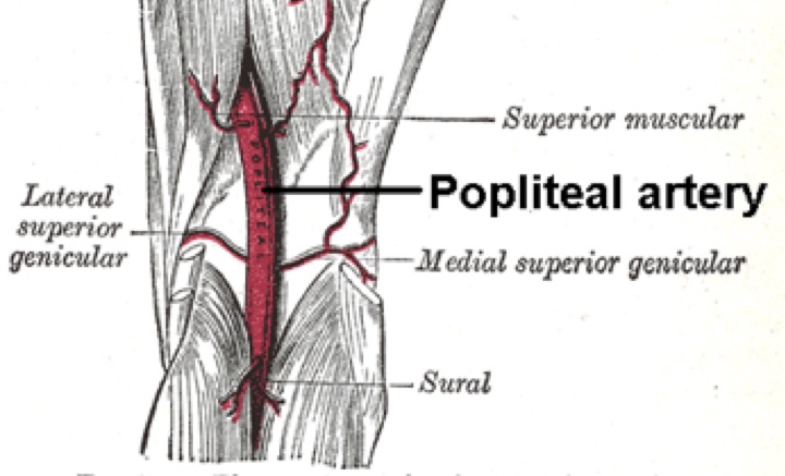 Φυσιολογική πορεία ιγνυακής αρτηρίας – popliteal artery